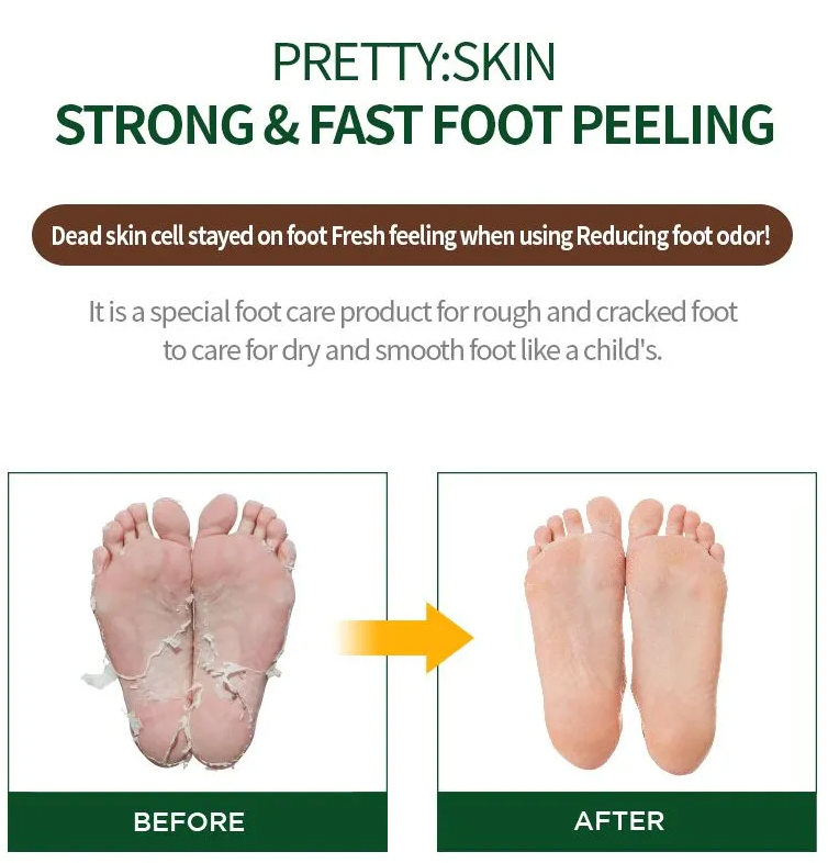 Korean Foot Peeling Mask by PRETTYSKIN (Strong & Fast) - Pack of 10
